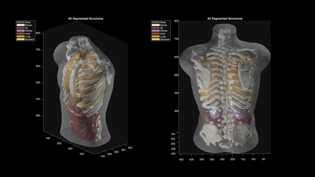 Midjourney amazes neural network developers have released an ultrasound full body scanner
